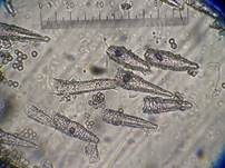 Feinwarziger Zystidenrindenpilz, Foto 15