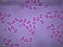 Feinzahniger Rindenpilz, Foto 15