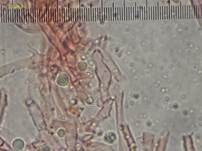 Feinzahniger Rindenpilz, Foto 17