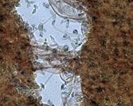 Fleischbräunlicher Helmling, Foto 20