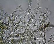 Fleischroter Gallertbecher, Foto 53