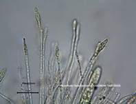 Fleischroter Gallertbecher, Foto 54