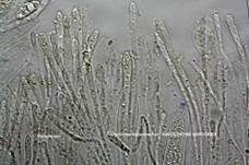 Fleischroter Gallertbecher, Foto 58