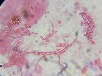 Fleischroter Gallertbecher, Foto 66