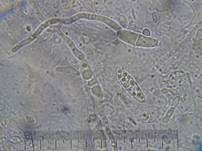 Fleischroter Gallertbecher, Foto 67