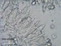 Gelbblättriger Weißtäubling, Foto 18