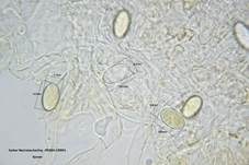 Gelber Wachsbecherling, Foto 19