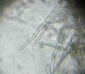 Gelbes Moosbecherchen, Foto 9