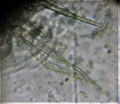 Gelbes Moosbecherchen, Foto 10