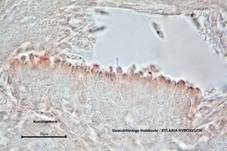 Geweihförmige Holzkeule, Foto 55