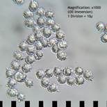 Goldflüssiger Milchling, Foto 13