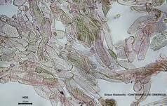 Graue Kraterelle, Foto 29