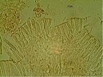 Hyalin-Knopfbecherchen, Foto 11