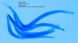 Kraushaar-Wasserpilz, Foto 9
