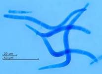 Kraushaar-Wasserpilz, Foto 10