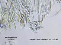 Ockergelbe Lorchel, Foto 14