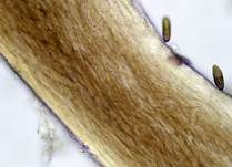 Pappel-Nagelpilz, Foto 13