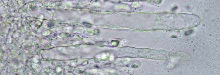 Purpurfarbige Keule, Foto 12