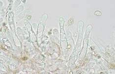 Rhomboidsporiger Flockenschüppling, Foto 10