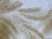 Rindensprengendes Eckscheibchen, Foto 16
