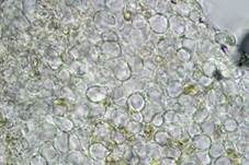 Schwarzfleckiger Schmierschirmling, Foto 17