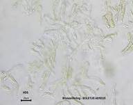 Schwarzhütiger Steinpilz, Foto 28
