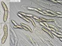 Striegeliger Kugelpilz, Foto 13
