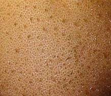 Weichlicher Stäubling, Foto 30