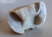 Braunschuppiger Wiesenchampignon, Foto 15