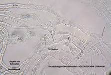 Dickschaliger Kartoffelbovist, Foto 50