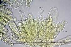 Dunkelroter Stachelbeertäubling, Foto 34