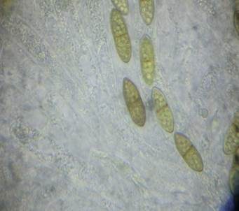 Ellipsenspor-Kernpilz, Foto 6