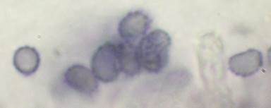 Feinwarziger Flockenschwamm, Foto 6