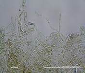 Fleischroter Gallertbecher, Foto 56